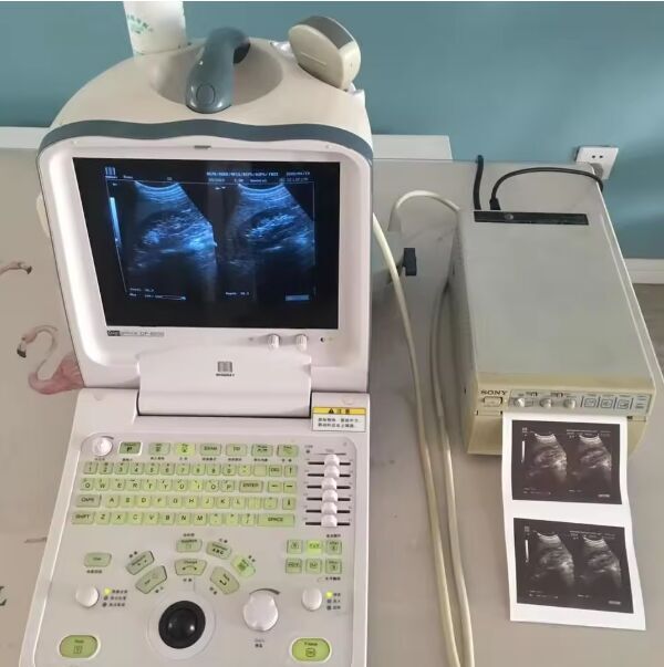 Mindray DP6600 Portable Ultrasound Scanner with Convex Probe