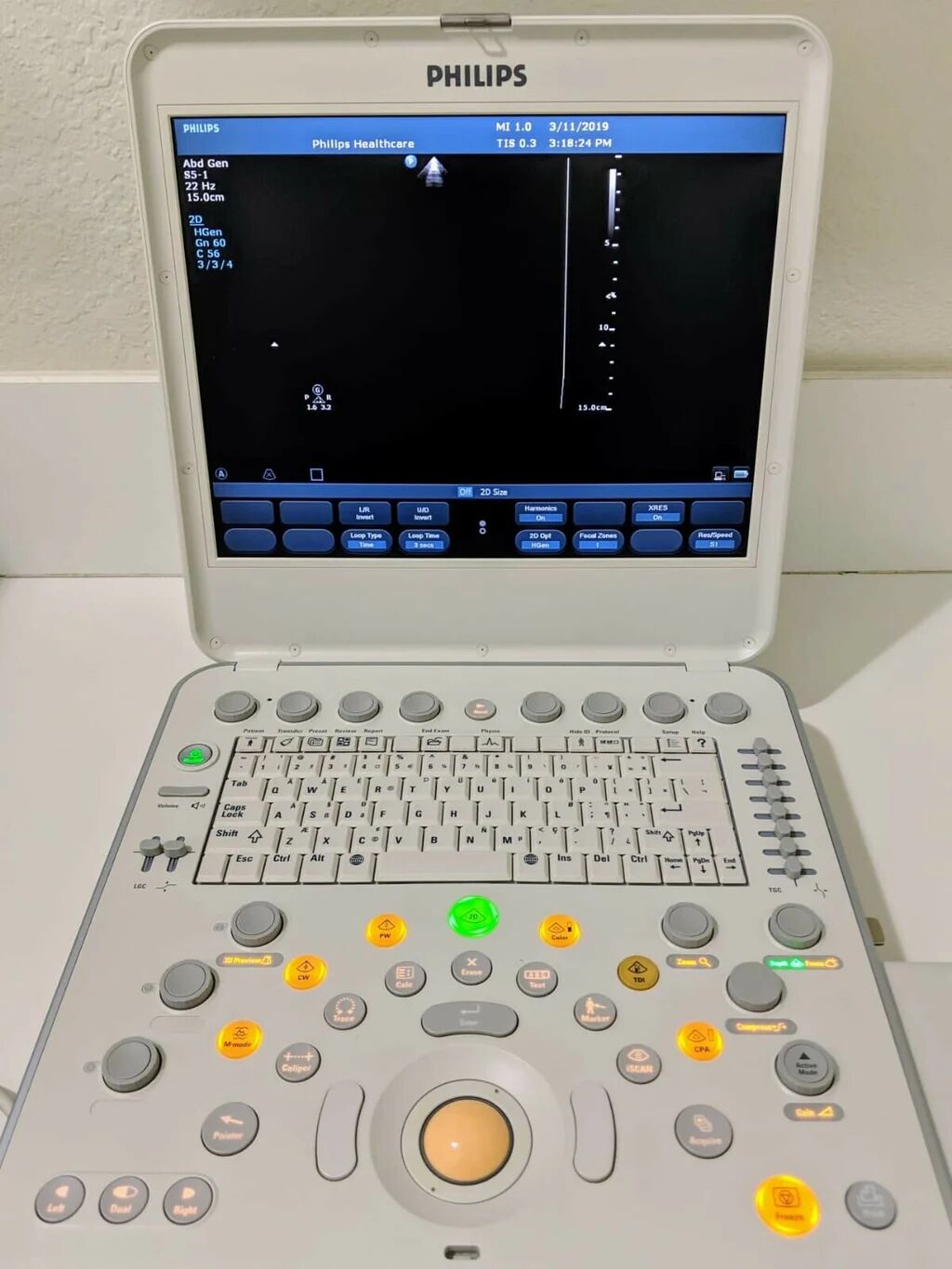 Philips CX50 Portable Ultrasound System
