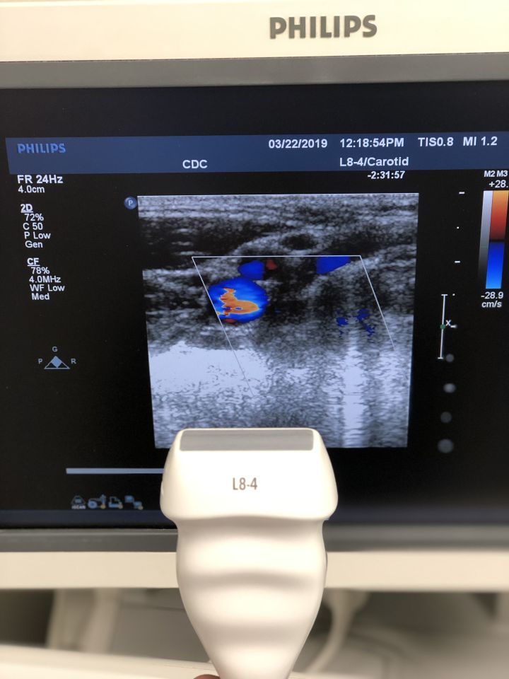 Philips L8-4 Linear Ultrasound Transducer Probe