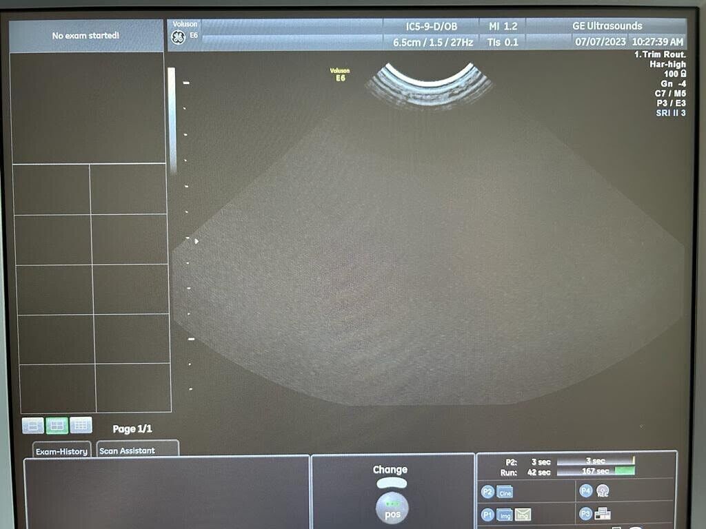GE IC5-9-D Intracavitary Ultrasound Transducer