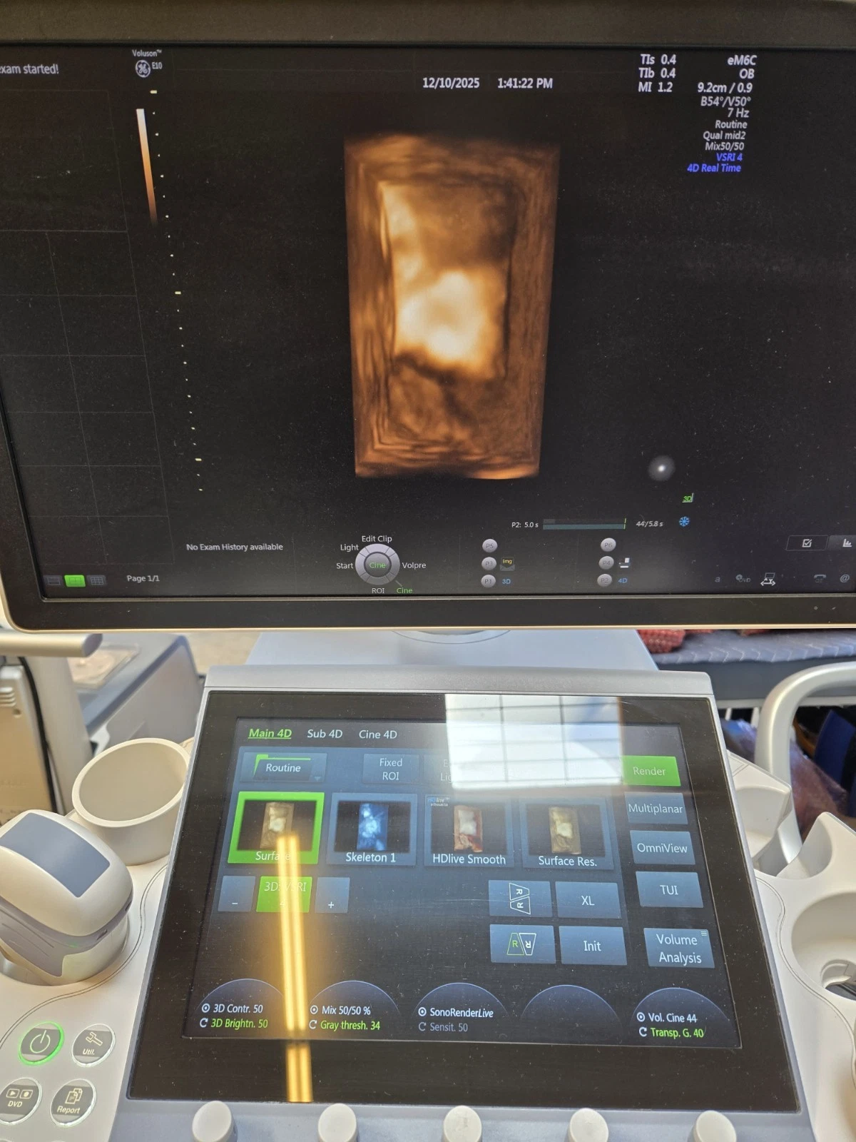 GE EM6C Electronic Micro-Convex Ultrasound Probe for LOGIQ and Versana Systems – Abdominal, OB/GYN, Pediatric and Emergency Imaging
