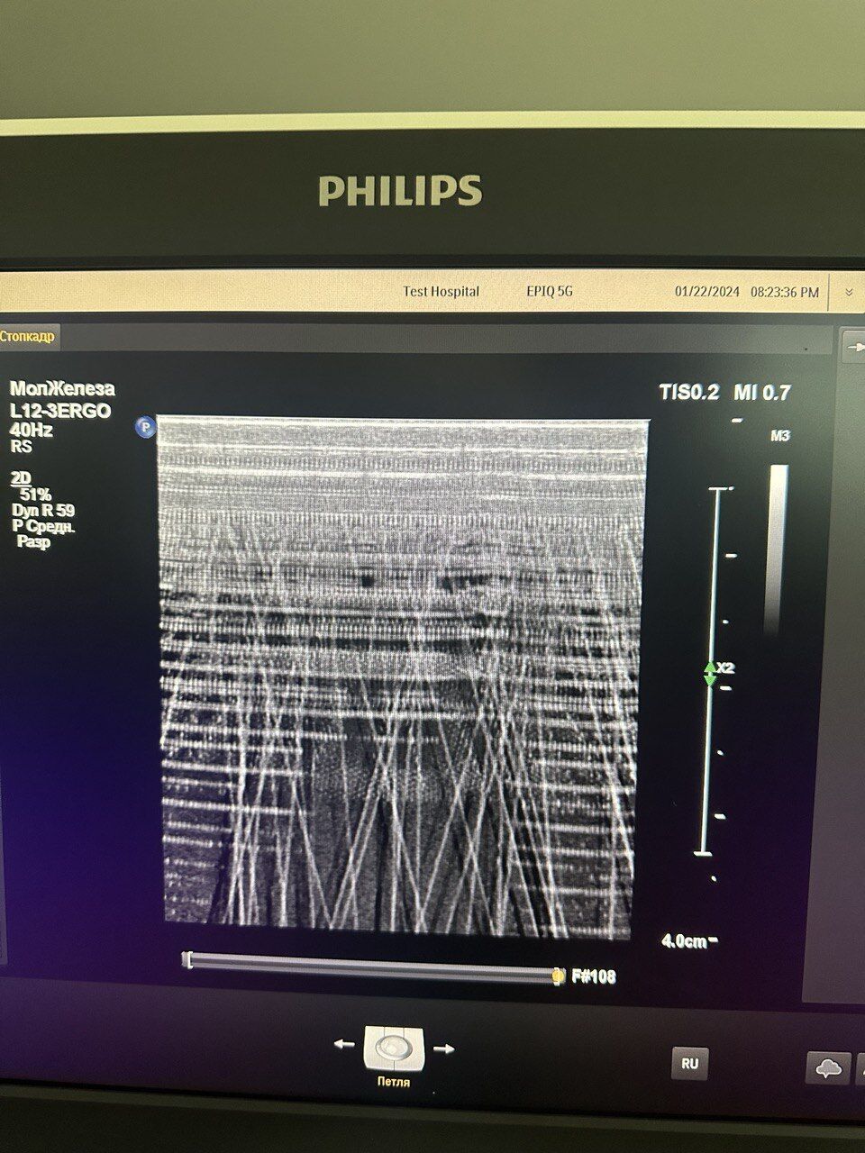 Philips Epiq 5G Ultrasound System