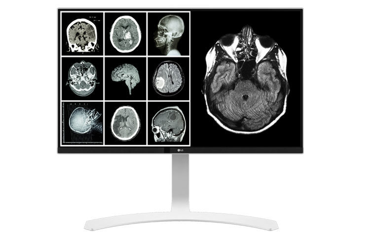 LG 27HJ712CS-W 8MP Clinical Review Monitor