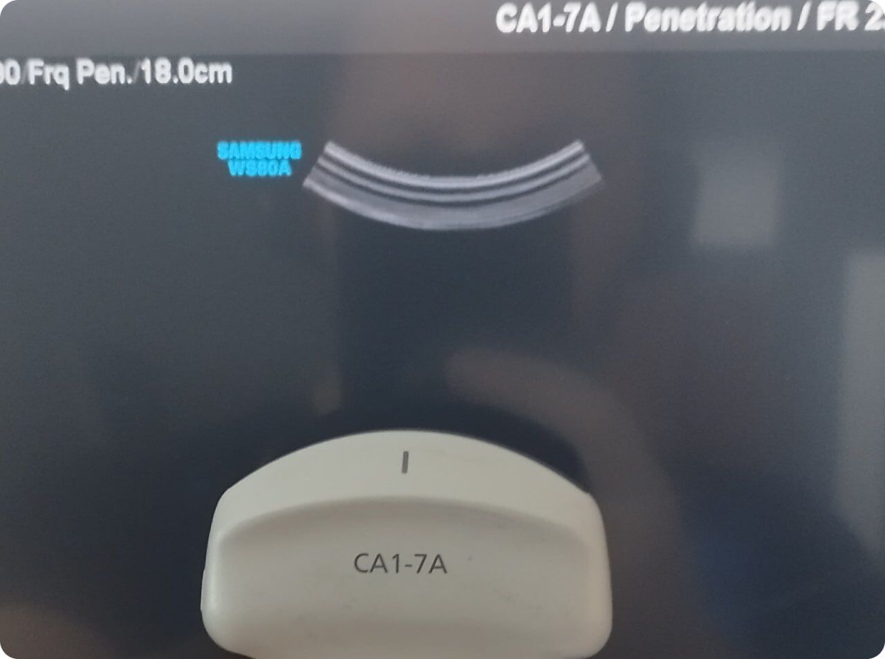 Samsung Medison WS80A Ultrasound System