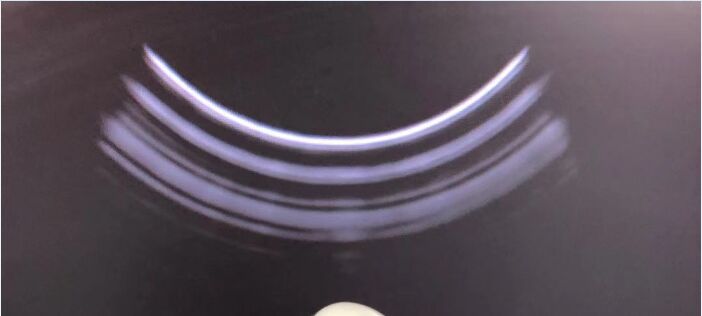 GE Logiq MTZ Endocavity Ultrasound Transducer