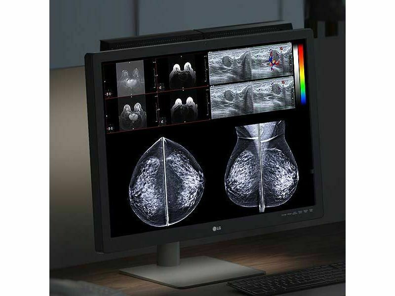 12MP Color Diagnostic Monitor: LG 31HN713D-B for PACS and Mammography