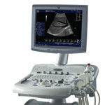 GE Logiq P3 OB/GYN and Vascular Ultrasound System