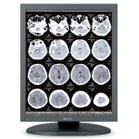 High-Resolution 3MP Sony LMD-DM30 Diagnostic Display Monitor
