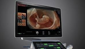GE Voluson E10 BT21 Ultrasound System with OLED Monitor